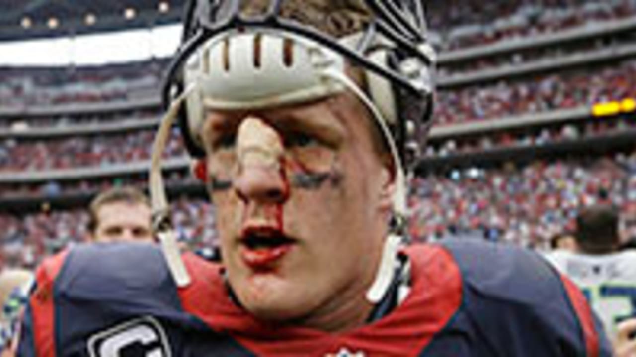 Houston Texans star J.J. Watt breaks leg in Kansas City Chiefs