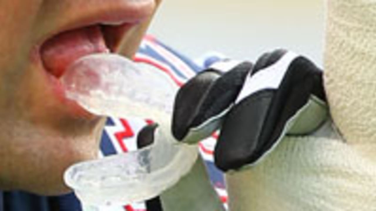 Mouthguard
