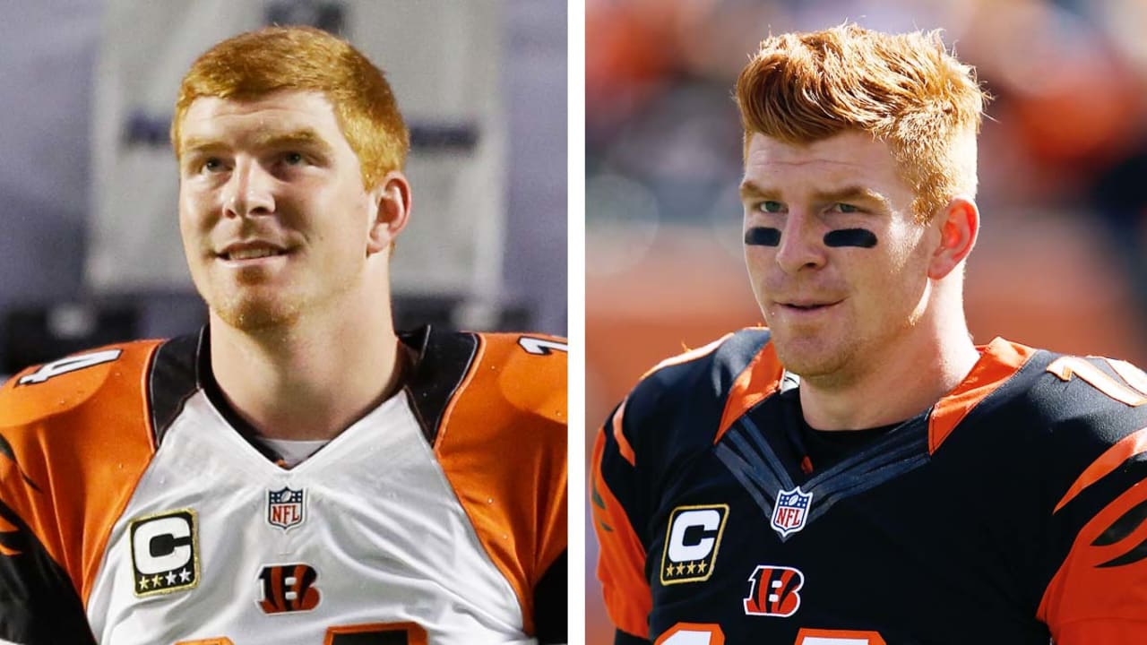 Secret to Andy Dalton's success: His hairstyle?