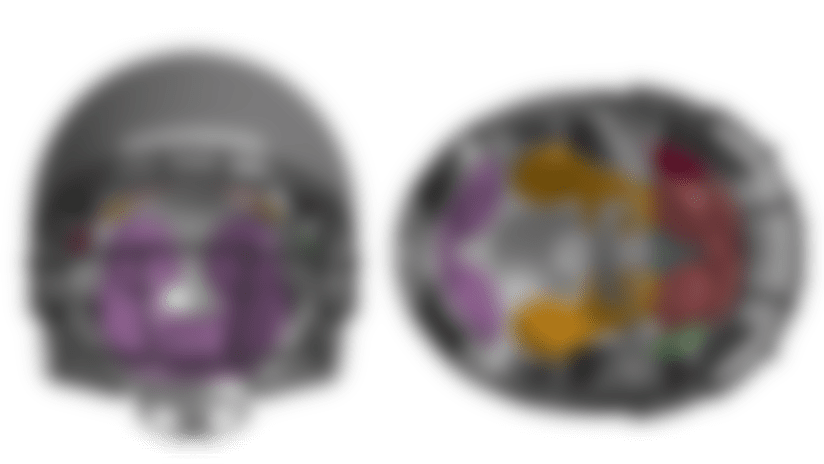 finite1