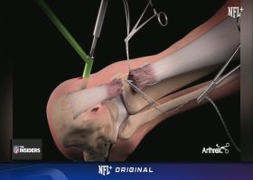 Rapoport diagrams Rodgers' Achilles surgery using skeletal model | 'The Insiders'